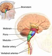 Image result for Gaoaxy Brain