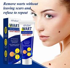 Image result for wart remove