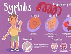 Image result for Syphilis Tongue Sores