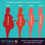 Image result for Gastric Sleeve Weight Loss Chart