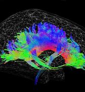 Image result for Super Brain