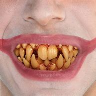 Image result for Fake Sharp Teeth