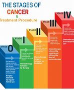 Image result for Stages of Cancer in the Human Body