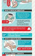 Image result for Recover CPR Animal