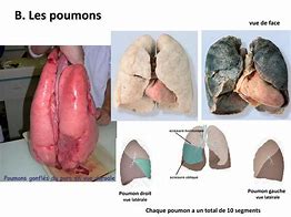 Image result for Poumon Pommier