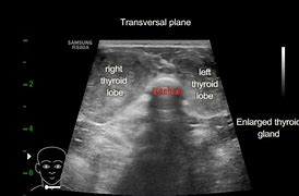 Image result for Canine Thyroid Tumor