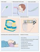 Image result for Suctioning Procedure