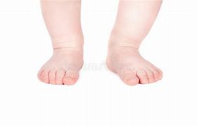 Image result for Isolated Child Foot