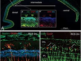 Image result for Retina Monitor