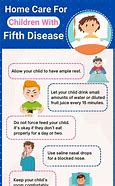 Image result for Fifth Treatment 5th Disease