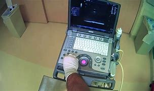 Image result for Fog Ultrasound Setup