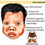 Image result for Thalassemia Mutation