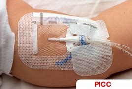 Image result for Cateter PICC