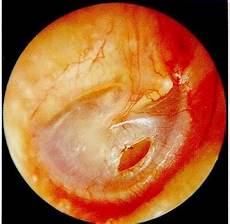 dermatite nell orecchio interno la malassezia malassezia pachydermatis causa di dermatiti dermatite nell orecchio interno la malassezia malassezia pachydermatis causa di dermatiti