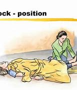Image result for Shock Position