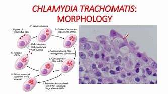 Image result for Chlamydia Trachomatis Structure