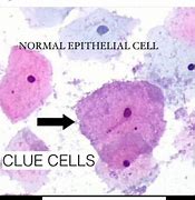 Image result for Clue Cells