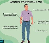Image result for Man with HIV