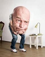 Image result for People with the Biggest Head in the World