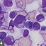 Image result for Small Cell Lymphoma in Cats