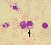 Image result for Granulocyte