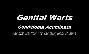 Image result for Internal Genital Warts
