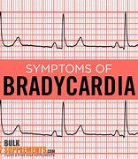bradycardia 的图像结果