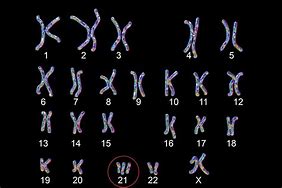 Image result for chromosom_3