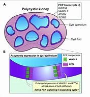Image result for Magnified PKD Cell