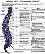 Image result for Chiropractic Pain Chart