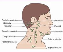 Image result for Lymph Node Distribution Head and Neck