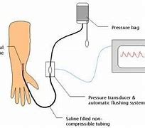 Image result for Central Venous Pressure Monitoring Stopcocks