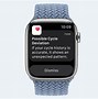 Image result for Apple Watch Chaffing Skin