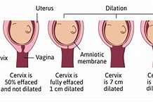 Image result for 3Cm Pregnancy