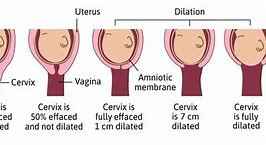 Image result for What Does 10Cm Dilated Look Like