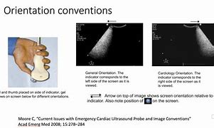 Image result for Ultrasound Screen Orientation