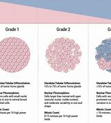 Image result for Cancer Tumor Size Chart