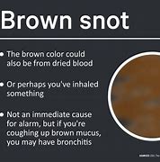 Image result for Mucus Color Indication