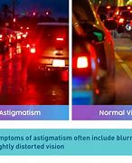 Image result for 3 Diopter Astigmatism