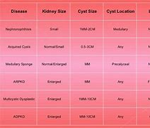 Image result for Kidney Cyst Size Chart