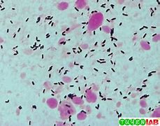 Image result for Amniotic Fluid Gram Stain