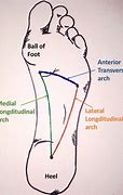 Image result for Foot Arch Shoes Wear
