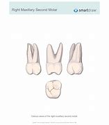 Image result for Maxillary Right Second Molar