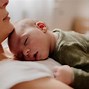 Image result for Anencephaly Nicu Baby