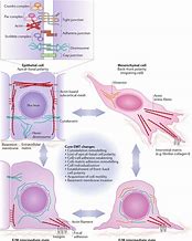 Image result for Epithelial-Mesenchymal Transition