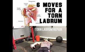 Image result for Torn Labrum Shoulder Exercises