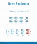 Image result for 21st Chromosome