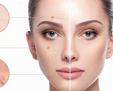 Image result for Types of Clogged Pores