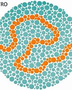 Image result for Grey Blue Color Blindness