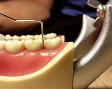 Image result for Periodontal Probe Gum